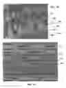 Fig. 07 - Method for mass transfer of micro-patterns onto medical devices