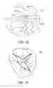 Fig. 06 - Reconfiguring Heart Features