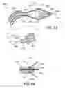 Fig. 12 - Reconfiguring Heart Features