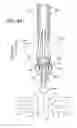 Fig. 14 - Reconfiguring Heart Features