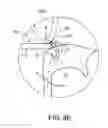 Fig. 18 - Reconfiguring Heart Features