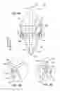 Fig. 10 - Reconfiguring Heart Features