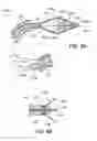 Fig. 12 - Reconfiguring Heart Features