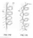 Fig. 45 - Reconfiguring Heart Features