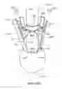 Fig. 49 - Reconfiguring Heart Features