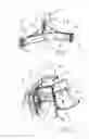 Fig. 02 - PROSTHESIS FOR REPAIRING HEART VALVES
