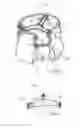 Fig. 03 - PROSTHESIS FOR REPAIRING HEART VALVES