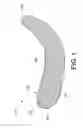 Fig. 02 - INFRA-ORBITAL IMPLANT