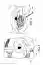 Fig. 05 - INFRA-ORBITAL IMPLANT
