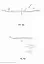 Fig. 02 - VISION CORRECTION SYSTEM
