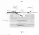 Fig. 18 - Flexible artificial retina devices