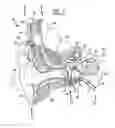 Fig. 02 - Universal implant