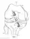 Fig. 02 - System and method for ligament reconstruction