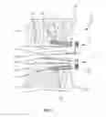 Fig. 02 - SPINAL IMPLANT