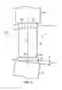 Fig. 02 - VERTEBRAL IMPLANT END CAP