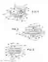 Fig. 02 - Intervertebral implant, insertion tool and method of inserting same