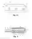 Fig. 08 - Device for distracting body tissue