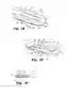Fig. 33 - Device for distracting body tissue