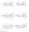 Fig. 01 - Set of glenoid components for a shoulder prosthesis