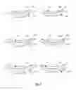 Fig. 03 - Set of glenoid components for a shoulder prosthesis