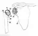 Fig. 01 - Modular humeral head resurfacing system