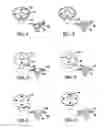 Fig. 03 - Modular humeral head resurfacing system