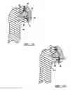 Fig. 05 - Modular humeral head resurfacing system