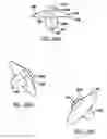 Fig. 14 - Modular humeral head resurfacing system