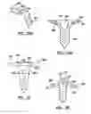 Fig. 15 - Modular humeral head resurfacing system