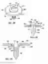 Fig. 16 - Modular humeral head resurfacing system