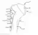 Fig. 01 - System and method for fracture replacement of comminuted bone fractures or portions thereof adjacent bone joints
