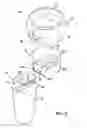Fig. 04 - Modular prosthesis and use thereof for replacing a radial head