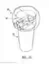 Fig. 05 - Modular prosthesis and use thereof for replacing a radial head