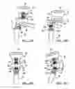 Fig. 14 - Modular prosthesis and use thereof for replacing a radial head
