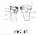 Fig. 12 - Low stress all poly tibial component