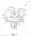 Fig. 02 - Tibial component of a knee prosthesis having an angled cement pocket