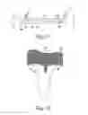 Fig. 09 - Tibial component of a knee prosthesis having an angled cement pocket