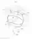 Fig. 20 - Hip joint device