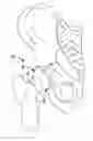 Fig. 01 - Acetabular Labrum Implant