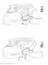 Fig. 02 - Acetabular Labrum Implant