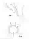 Fig. 05 - Acetabular Labrum Implant
