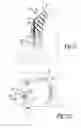 Fig. 07 - Acetabular Labrum Implant