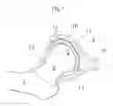 Fig. 02 - Hip joint device, system and method