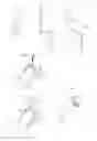 Fig. 08 - Hip joint device, system and method