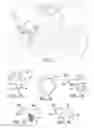 Fig. 02 - Acetabular Cartilage Implant
