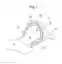 Fig. 02 - Medical device and a method for treating a hip joint