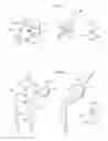 Fig. 16 - Medical device and a method for treating a hip joint