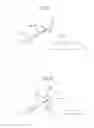 Fig. 20 - Medical device and a method for treating a hip joint