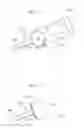 Fig. 35 - Medical device and a method for treating a hip joint