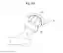 Fig. 48 - Medical device and a method for treating a hip joint